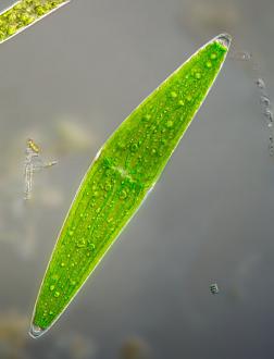 Click image for larger version

Name:	880_Wolfgang+Bettighofer+Entry_19532_Closterium-lunula-580x759.jpg
Views:	1
Size:	54.2 KB
ID:	1356337