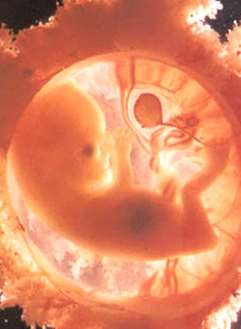 Click image for larger version

Name:	26842890.jpg
Views:	1
Size:	25.2 KB
ID:	1305584